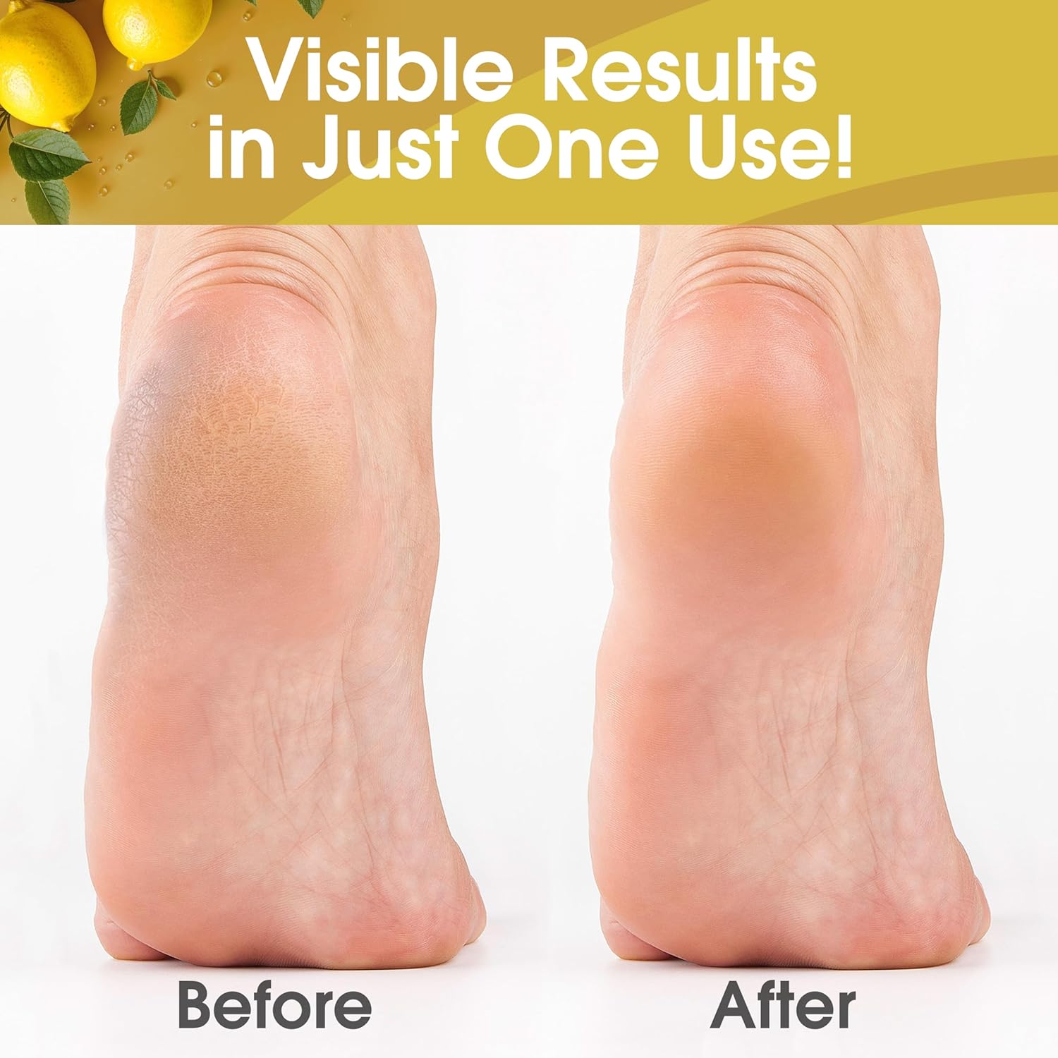 Lemon Callus Remover Gel - 16 fl. oz. - Image 8